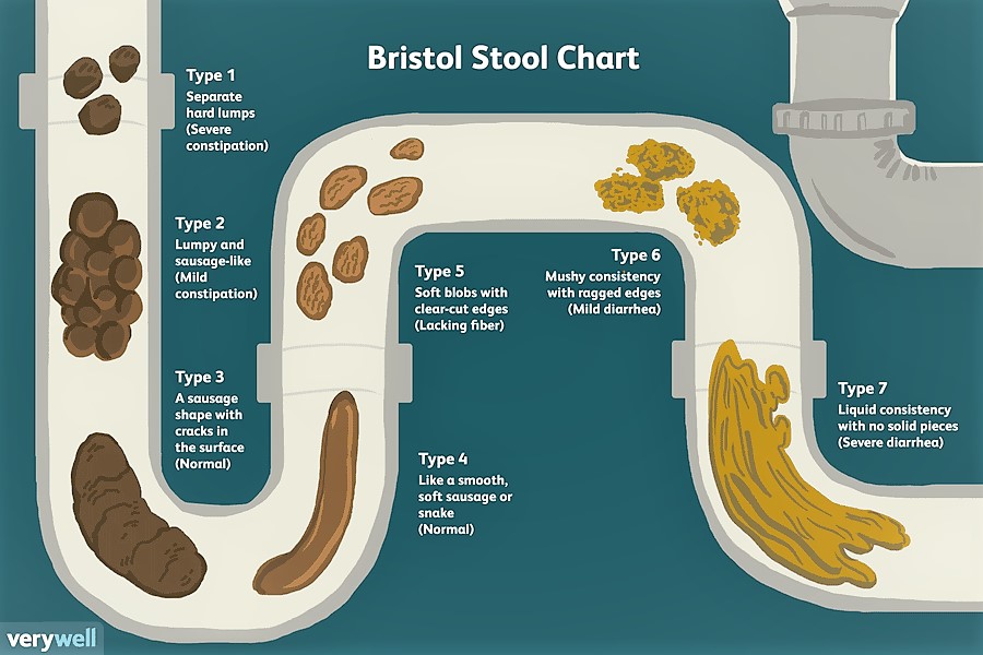 View your poo | Welcome to Shirl's Pearls: My Guide to a Good Life!